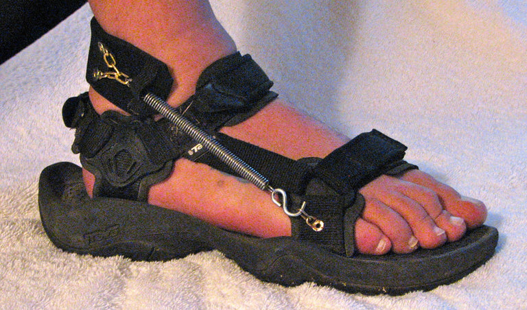 Chris wearing Freedom Walk AFO Free Flex Drop Foot Brace with a black sandal